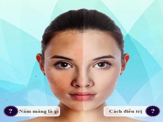 Doctor Mezo – đánh bay nám mảng